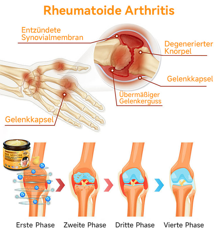 Bienen-Vital-Creme | Rask smertelindring | Luvikno