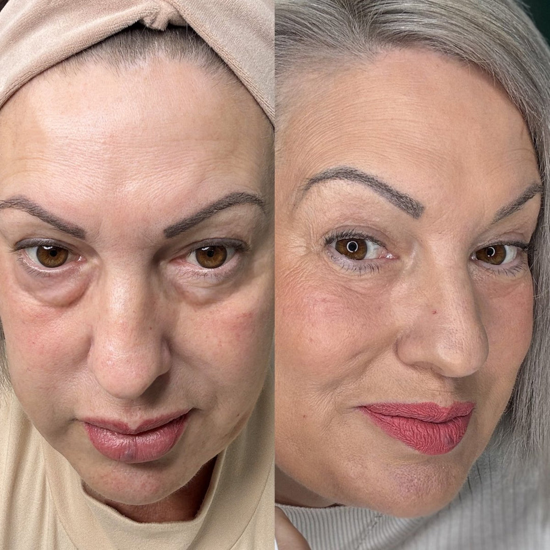Luvikno | EyeRevive | Strålende og friskhet gjenvunnet