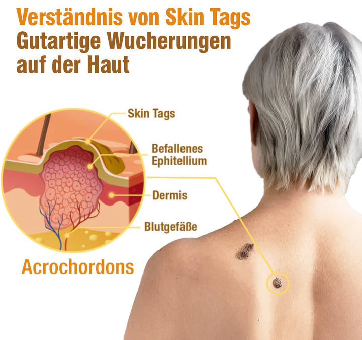 TagRecede Bee Gift Spray | Naturlig Hudperfeksjon | Luvikno