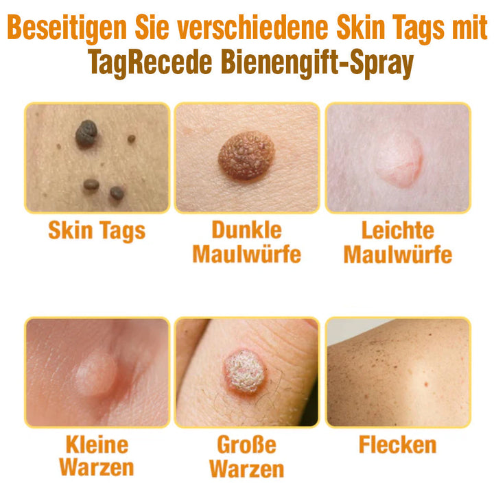 TagRecede Bee Gift Spray | Naturlig Hudperfeksjon | Luvikno