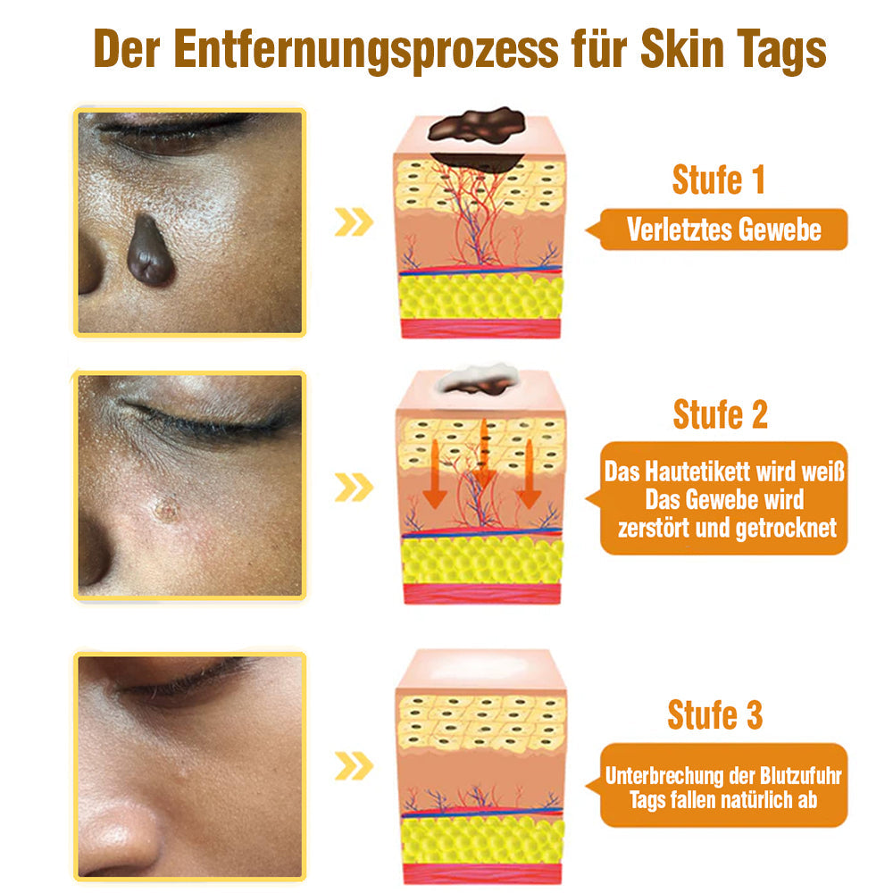TagRecede Bee Gift Spray | Naturlig Hudperfeksjon | Luvikno
