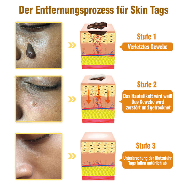 TagRecede Bee Gift Spray | Naturlig Hudperfeksjon | Luvikno