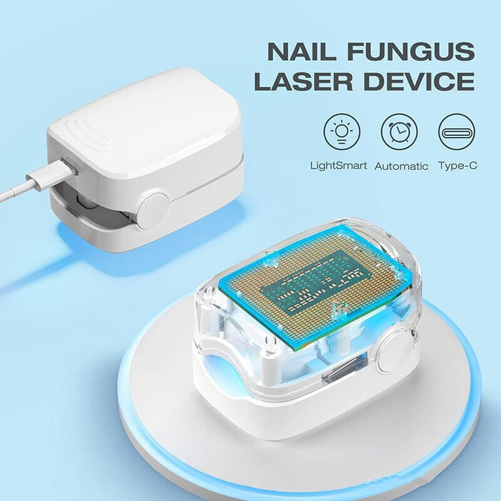 Laser enhet for neglesopp rengjøring – Revolusjonerende, svært effektivt lysbehandlingsapparat fra Expert for tånegs sykdommer Luvikno