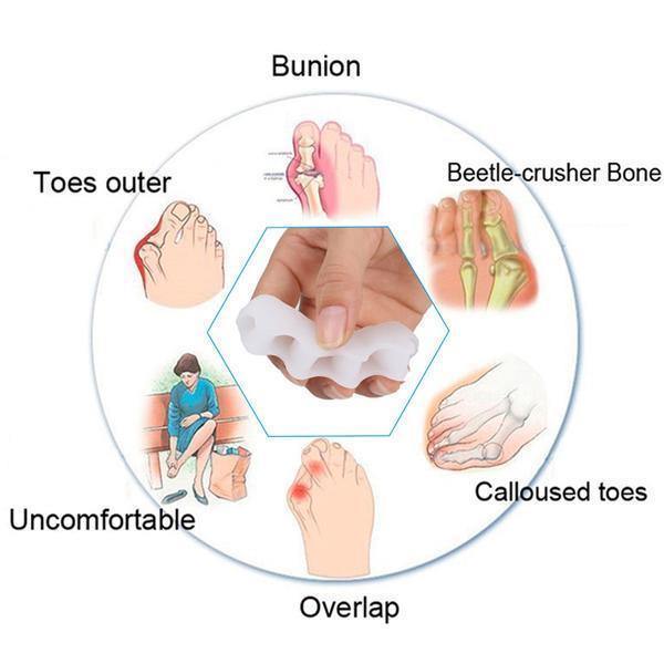 Luvikno | Tå-retting | Ortopedisk Hallux og Hammer tå korrigerer med tåskiller