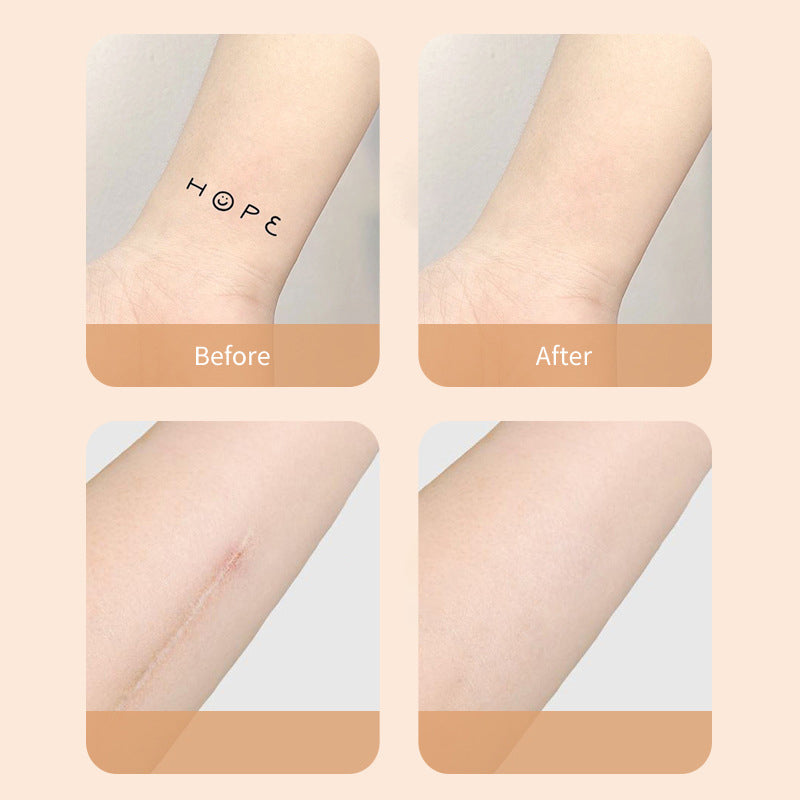 Nye produkter Ultra-Tynn Tatovering og Arr Concealer Patch Luvikno